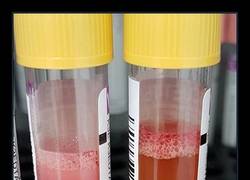 Enlace a MUESTRAS DE SANGRE