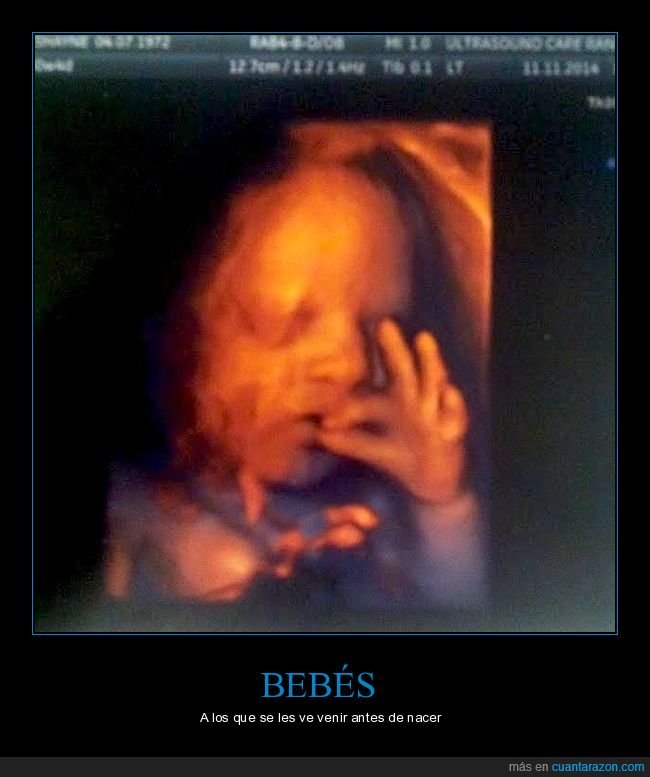 bebé,feto,fumando,wtf,ecografía