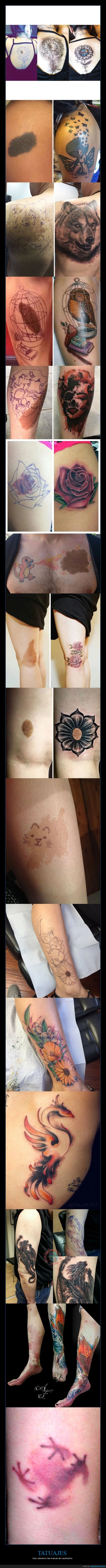 tatuajes,marcas de nacimiento,cubrir
