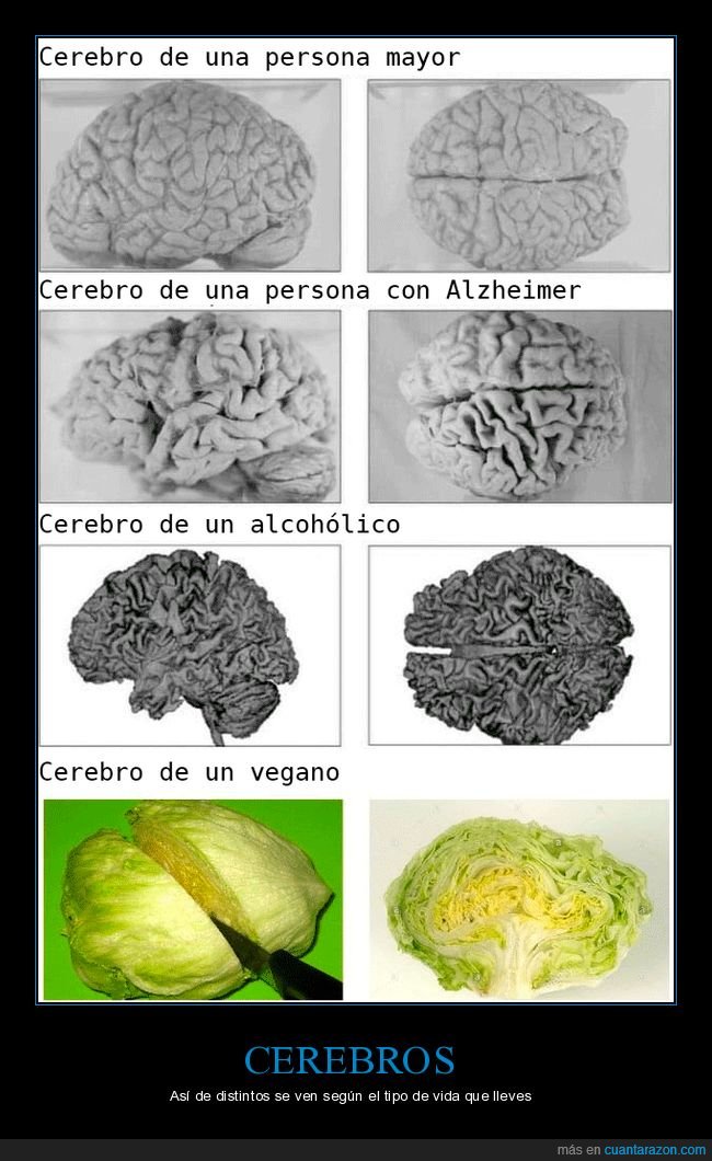 cerebros,alzheiner,alcohólico,vegano