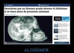Enlace a Avances contra el Alzheimer