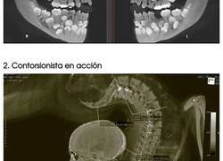 Enlace a Asombrosas fotografías de rayos X que te dejarán con la boca abierta