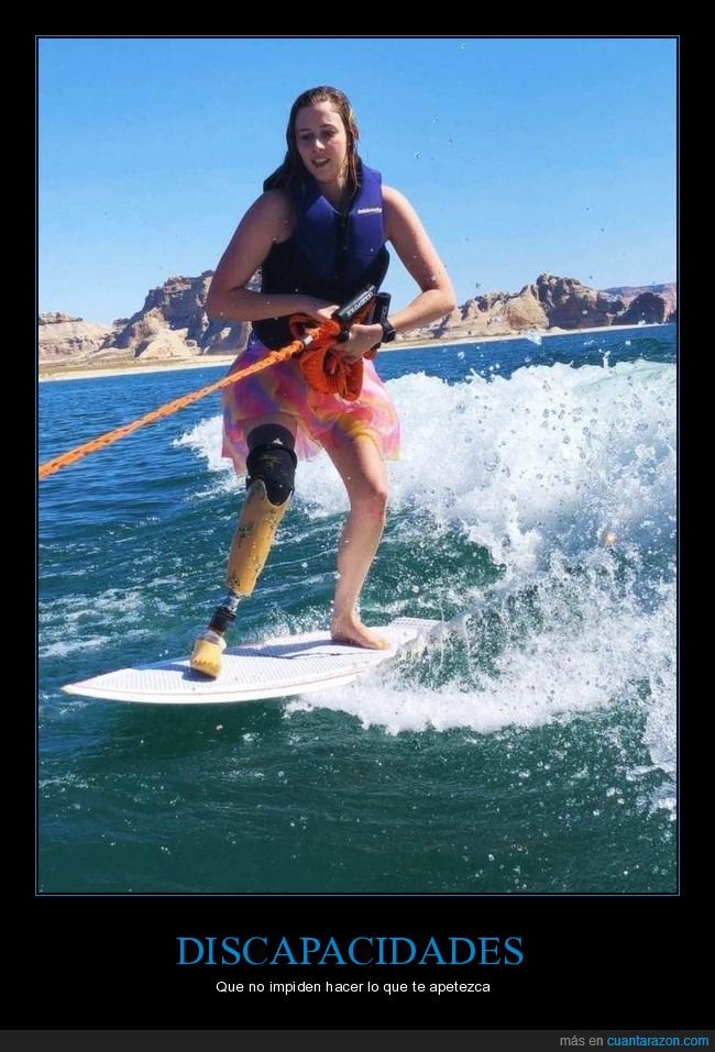 pierna,surf,discapacidad