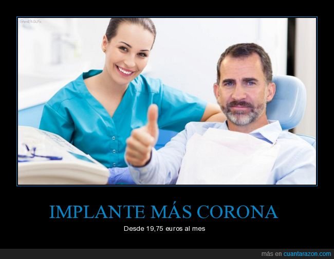 implante,corona,dentista,rey