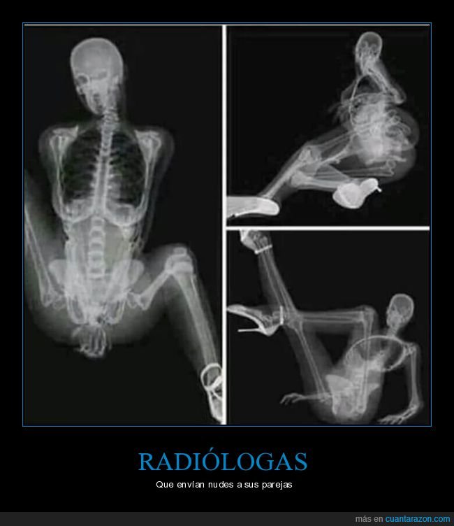 radiologa,nudes,radiografía