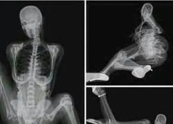 Enlace a Radiólogas que mandan nudes