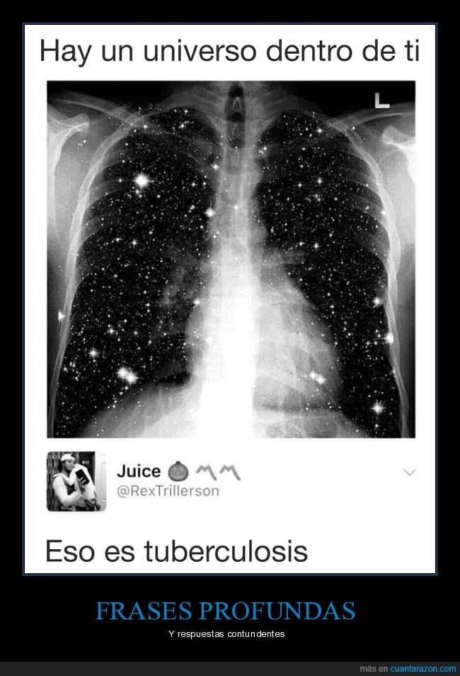 universo,dentro,tuberculosis