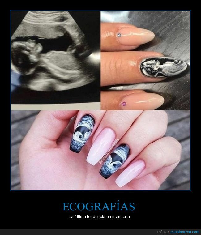 ecografía,uñas,manicura
