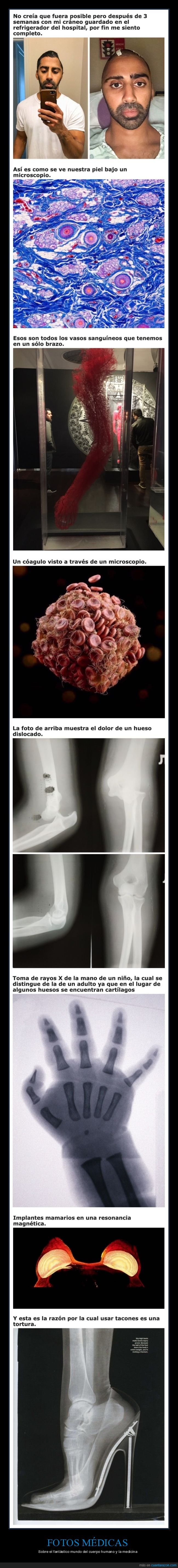 cuerpo humano,fotos médicas,curiosidades
