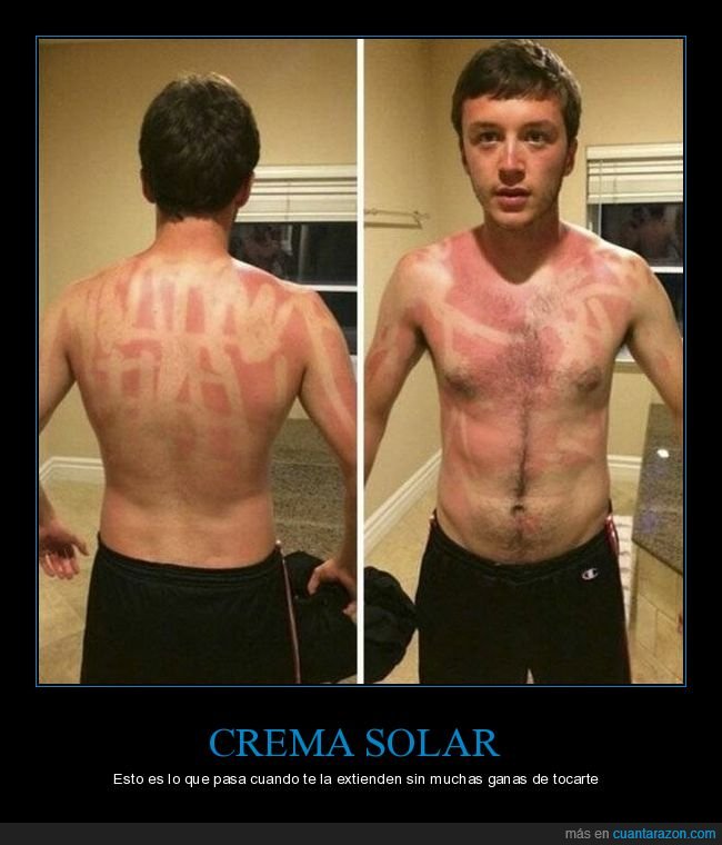 crema solar,quemado,fails