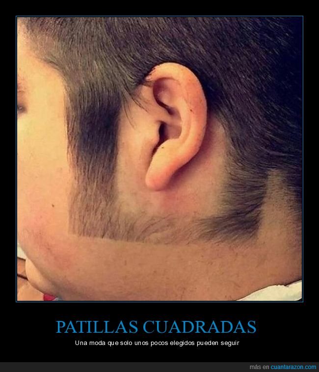 patillas,cuadradas,wtf