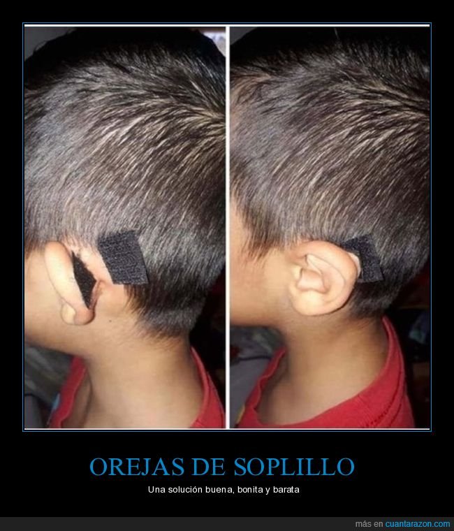 velcro,orejas,ni&ntilde;o,soplillo