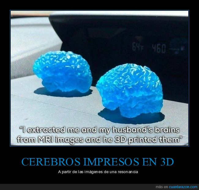 cerebros,impresora 3d,resonancia