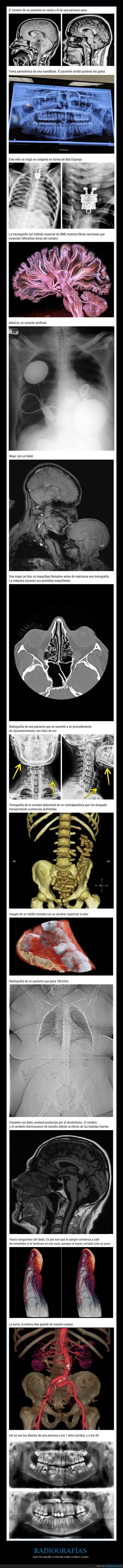 radiografías,cuerpo humano,curiosidades