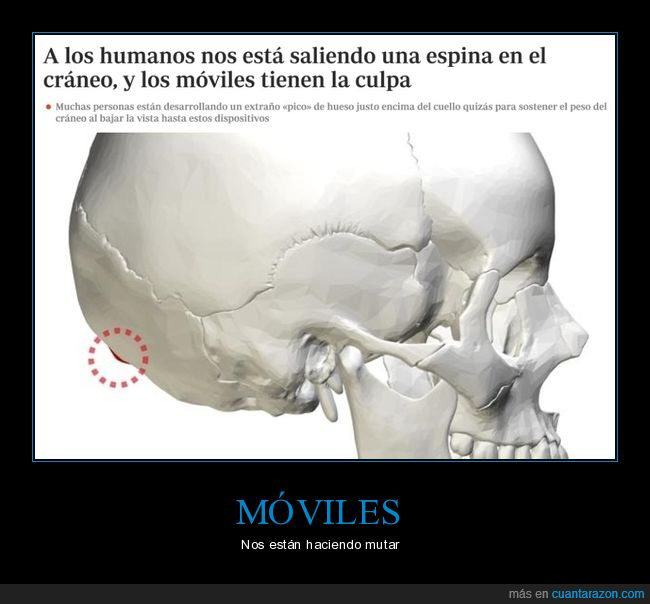 espina,cráneo,móviles,wtf