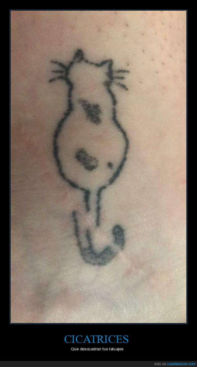 cicatriz,tatuaje,descuadrado