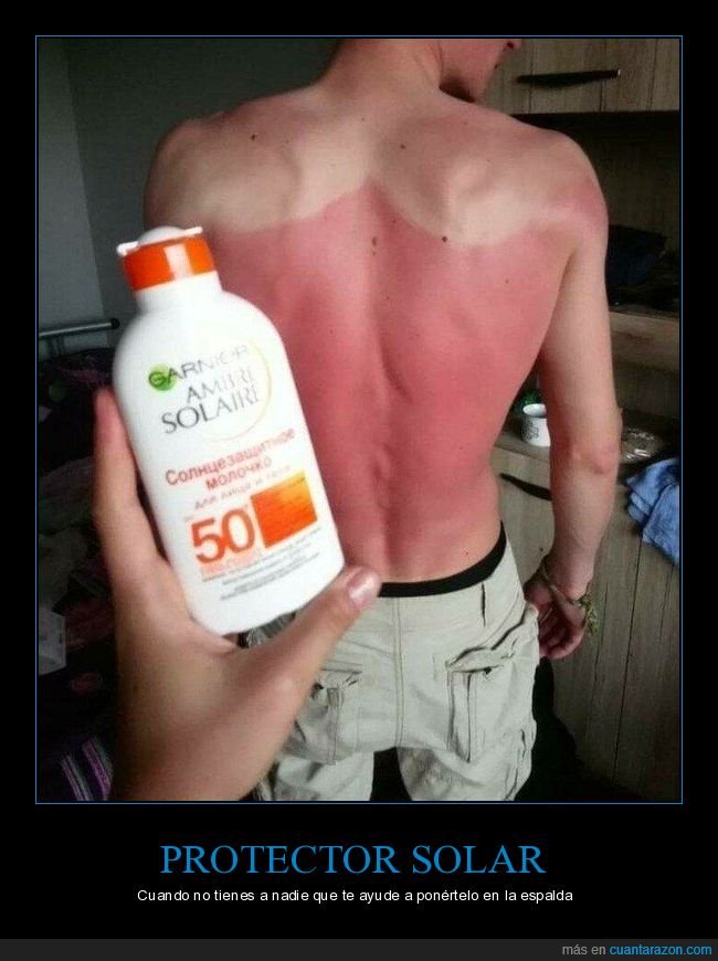 protector solar,espalda,quemado,fails