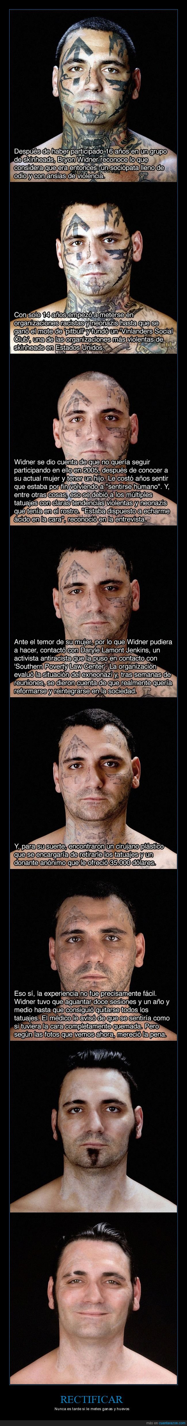 nazi,tatuajes,cambiar,rostro,cirug&iacute;a