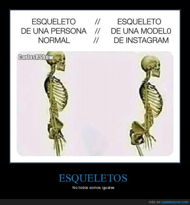 esqueleto,instagram