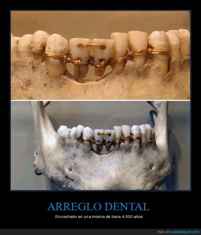 arreglo,dientes,momia