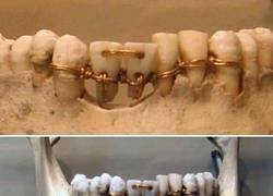 Enlace a Ortodoncia egipcia