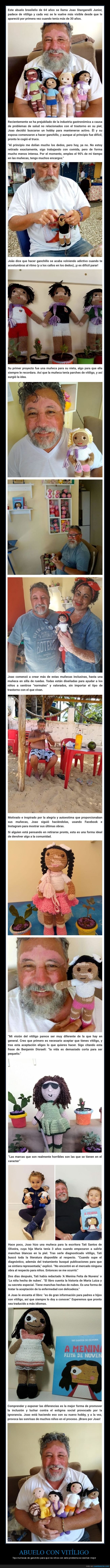 abuelo,vitíligo,muñecas