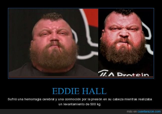 eddie hall,levantamiento,pesas,hemorragia cerebral,peso
