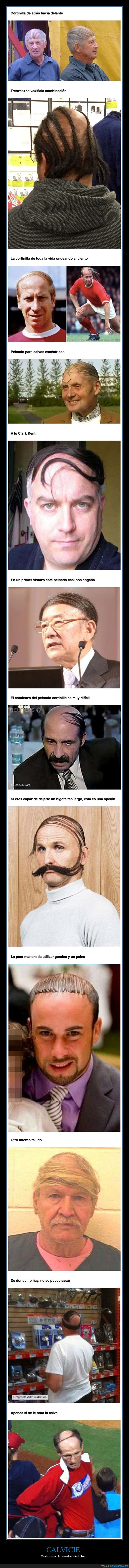 calvicie,calvos,pelo,peinados,fails