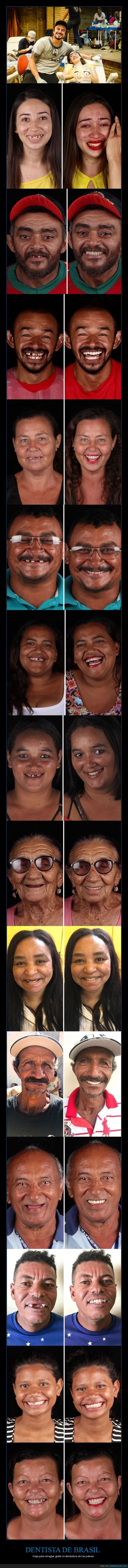 dentista,brasil,dentadura,dientes,pobres,antes,después