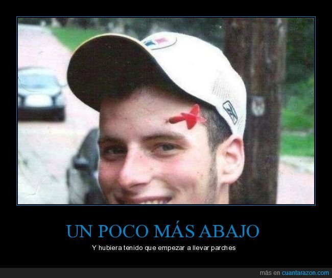 dardo,frente,cara,fails,wtf