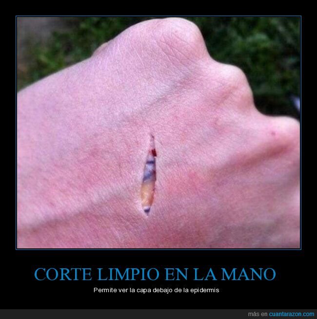 corte limpio,mano,epidermis