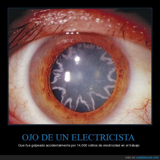 ojo,electricista,electrocutado