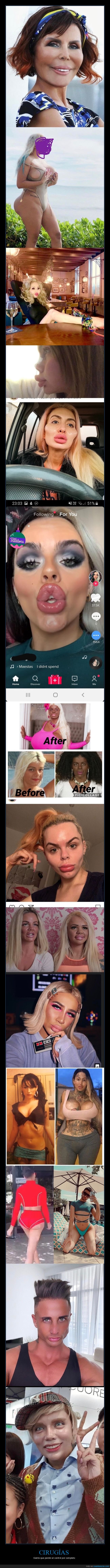 cirugías,aspecto,fails