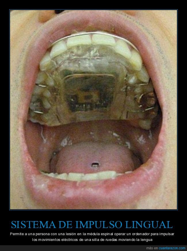 sistema de impulso,lengua,lesión en la médula espinal,silla de ruedas