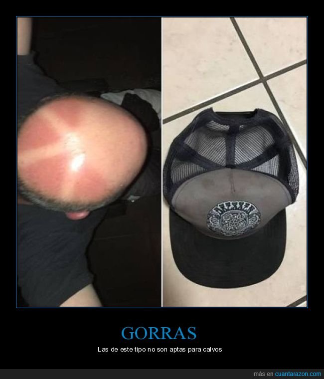gorra,calvo,quemado,fails