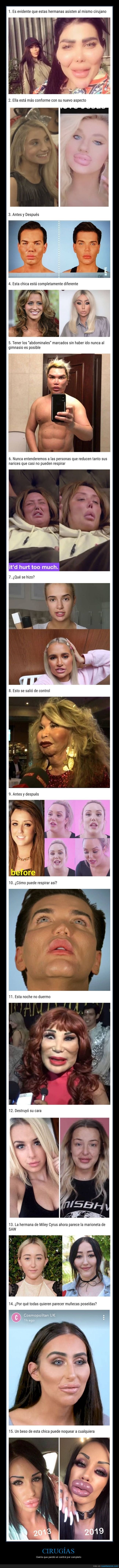 cirugías,aspecto,fails