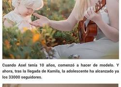 Enlace a Estas hermanas albinas se llevan 12 años, pero asombran al mundo con su belleza