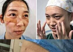 Enlace a Enfermeras chinas comparten fotos de cómo se ven sus rostros después de incontables horas luchando contra el coronavirus