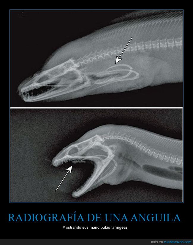 radiografía,anguila,mandíbulas faríngeas
