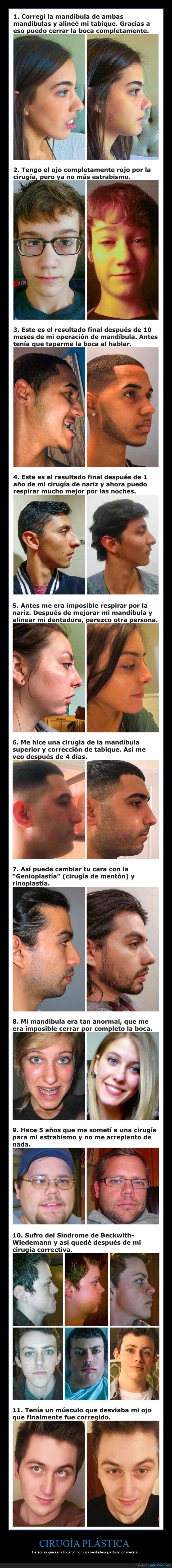 cirugías,justificación médica,antes,después