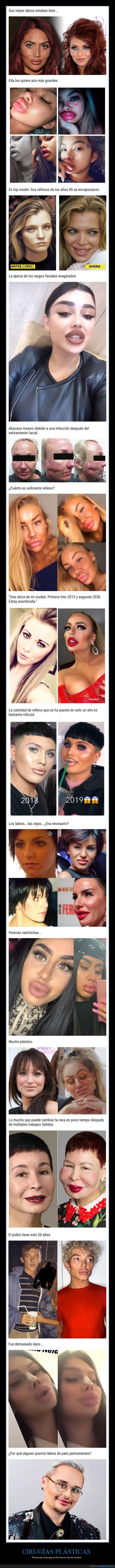 cirugías,aspecto,fails