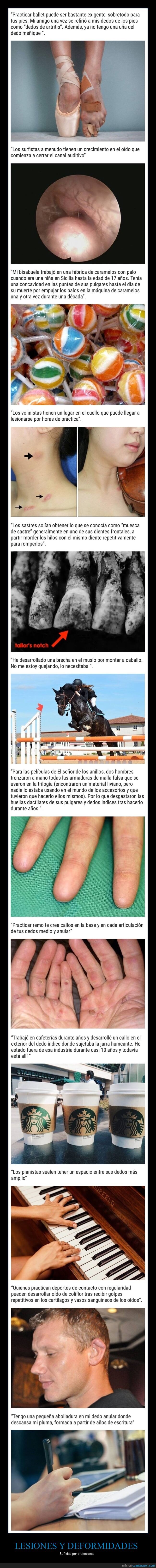 lesiones,deformidades,profesiones