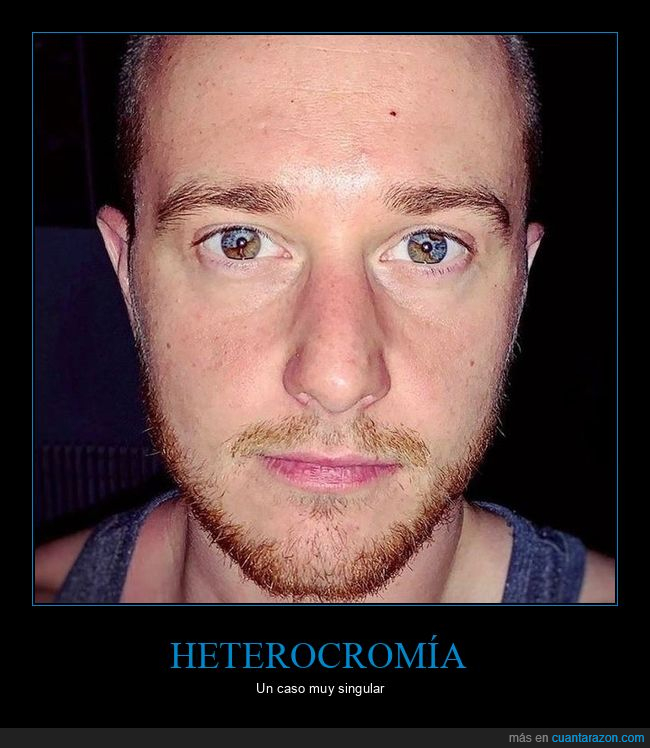 heterocromía,ojos,color