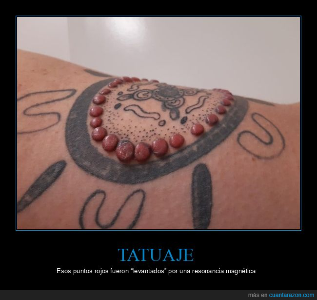tatuaje,puntos rojos,resonancia