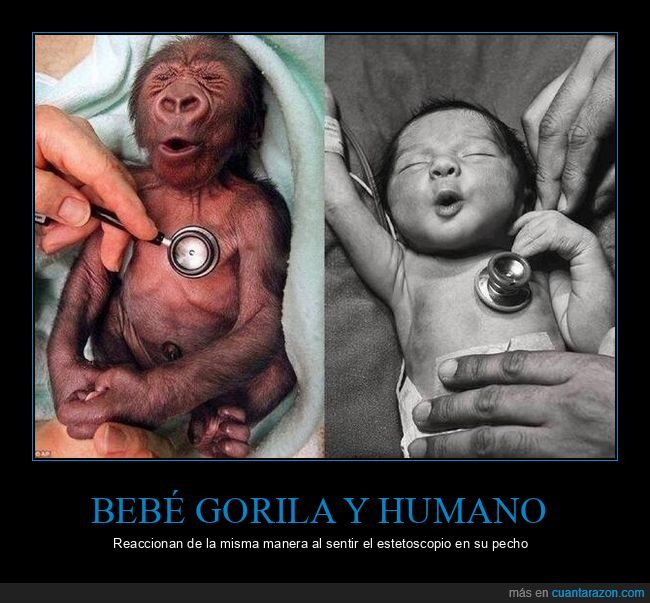 bebés,gorila,humano,reaccionar,estetoscopio