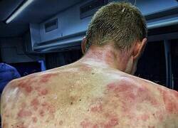 Enlace a Granizo doloroso