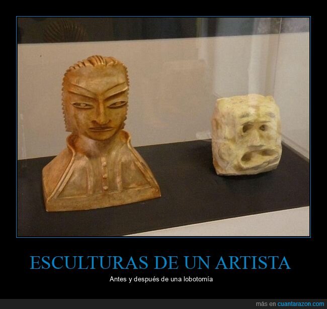 esculturas,artista,antes,después,lobotomía