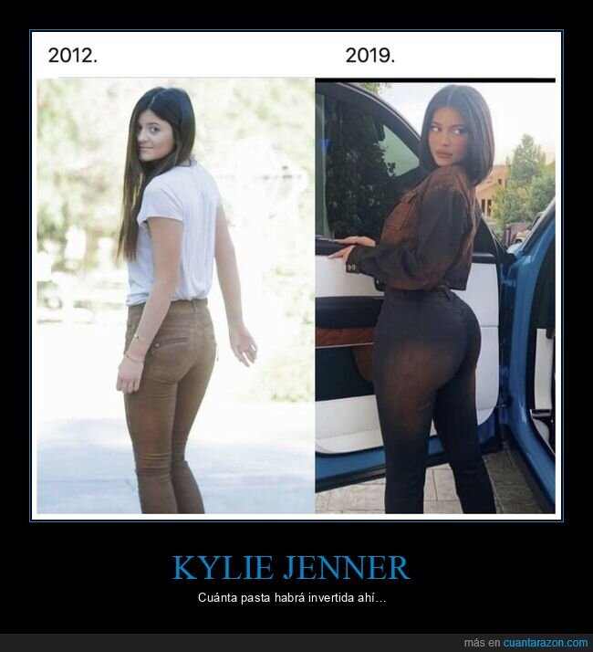 antes,después,kylie jenner