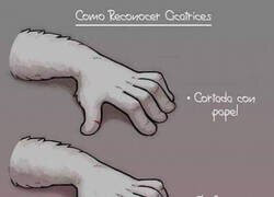 Enlace a Niveles de cicatrices