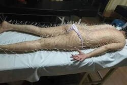 Enlace a Exceso de estrés